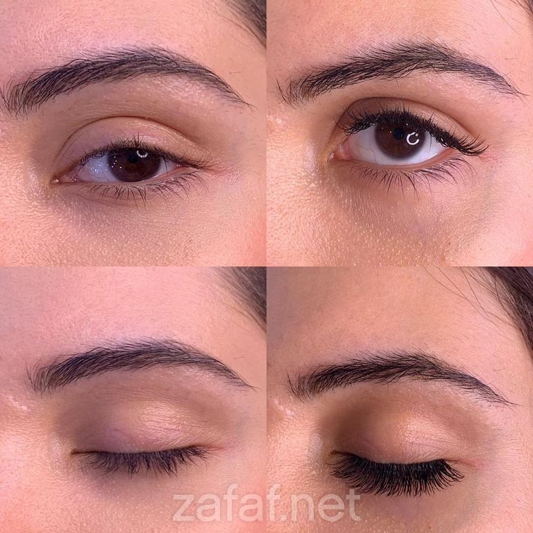 مركز رونزا للتجميل